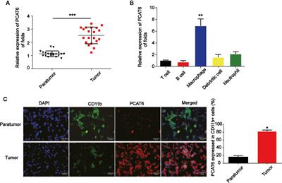 Long Non-Coding RNA PCAT6 Induces M2 Polarization of Macrophages in Cholangiocarcinoma via Modulating miR-326 and RhoA-ROCK Signaling Pathway